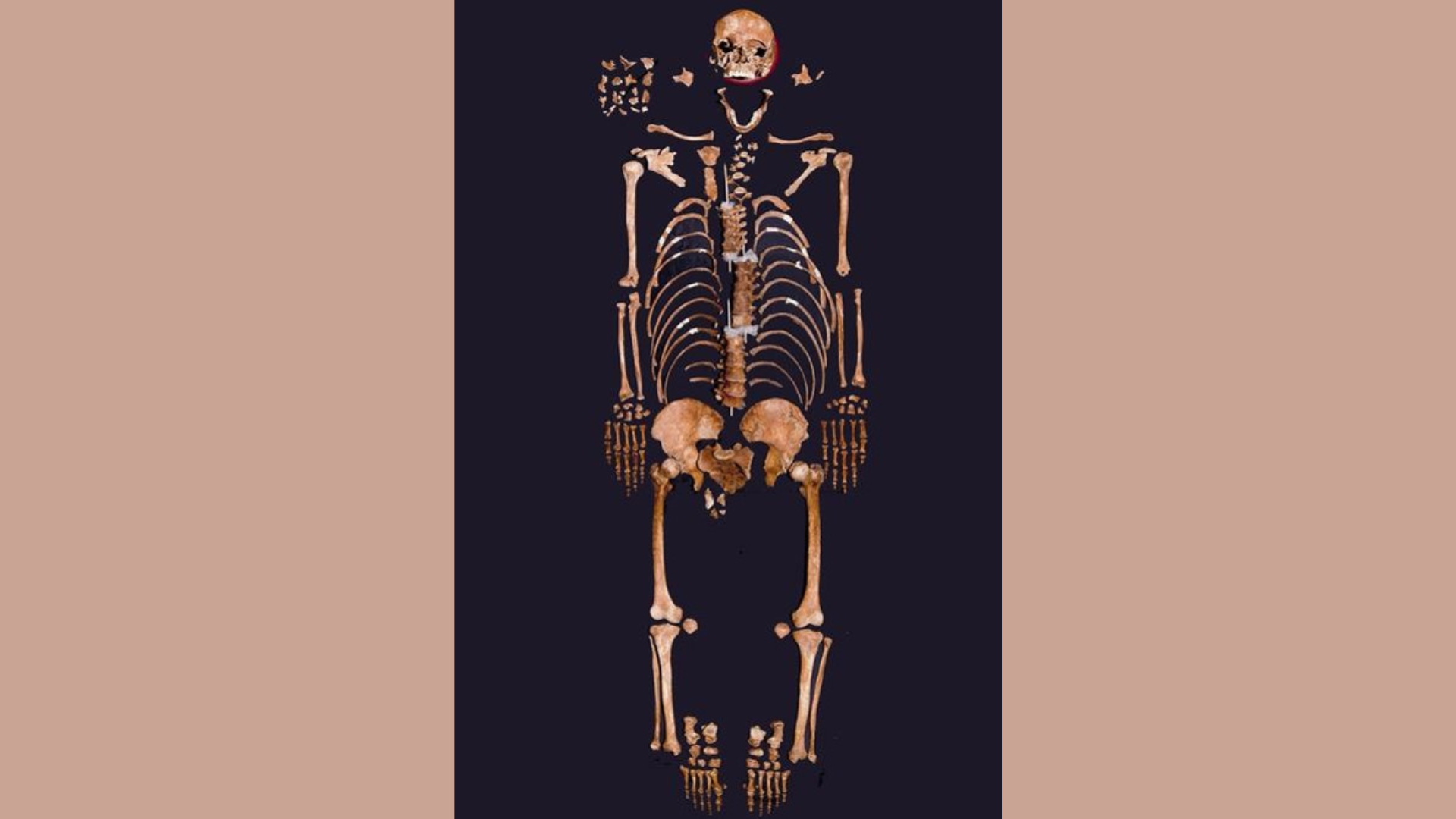 La biorarcheologia  dei resti umani consente l’acquisione di molte informazioni sugli individui: età, sesso, altezza, dieta, condizioni di salute, malattie, malformazioni, colpi violenti inferti ecc.